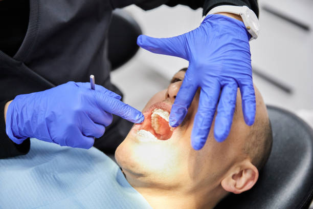 Best Knocked-Out Tooth (Avulsed Tooth) Treatment in Brookville, IN